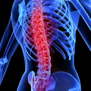 Spinal-cord-injury-paralysis